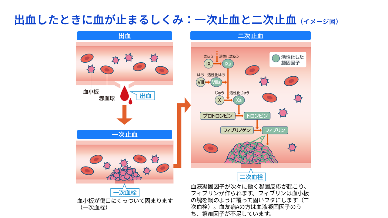 出血したときに血が止まるしくみ：一次止血と二次止血（イメージ図）