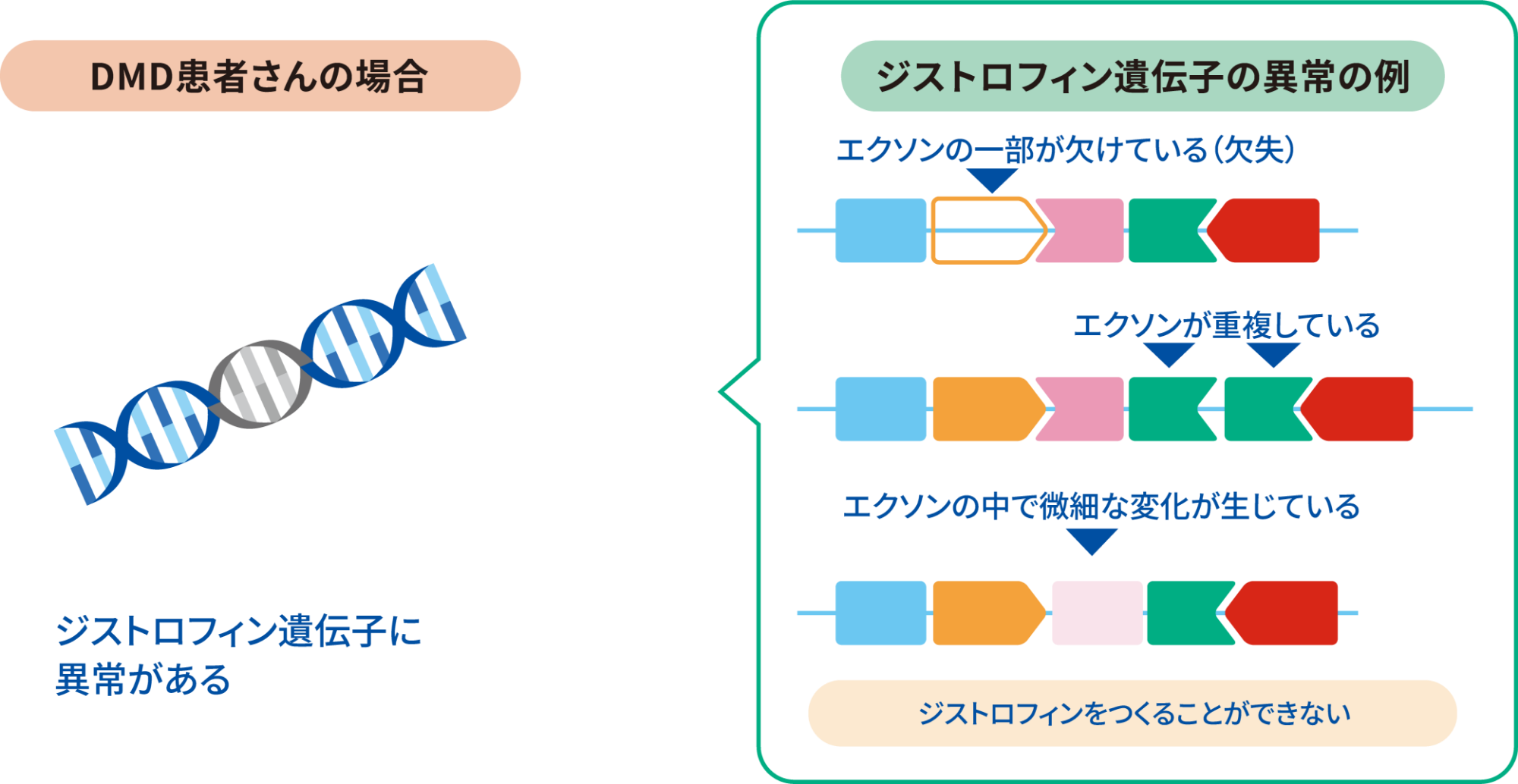 ジストロフィン遺伝子の異常を示す図